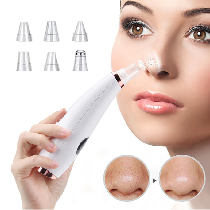 Electric Blackhead Remover -  Acne & Pore Cleaner Machine