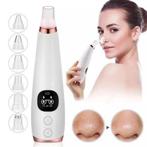 Electric Blackhead Remover -  Acne & Pore Cleaner Machine
