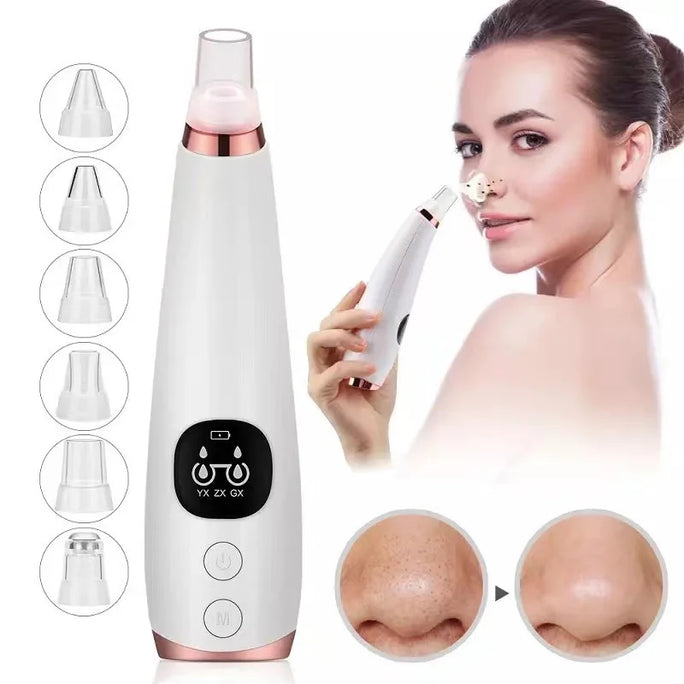 Electric Blackhead Remover -  Acne & Pore Cleaner Machine