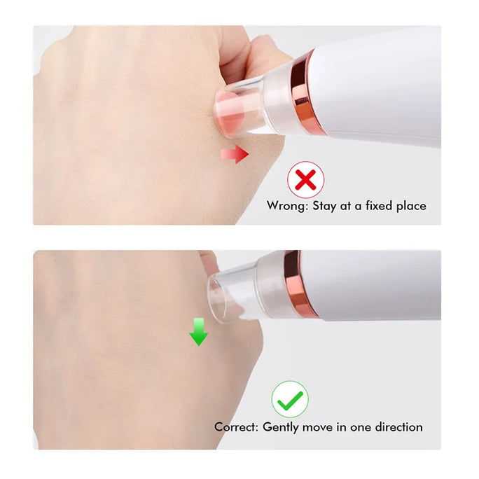 Electric Blackhead Remover -  Acne & Pore Cleaner Machine