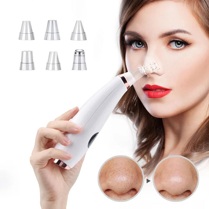 Electric Blackhead Remover -  Acne & Pore Cleaner Machine
