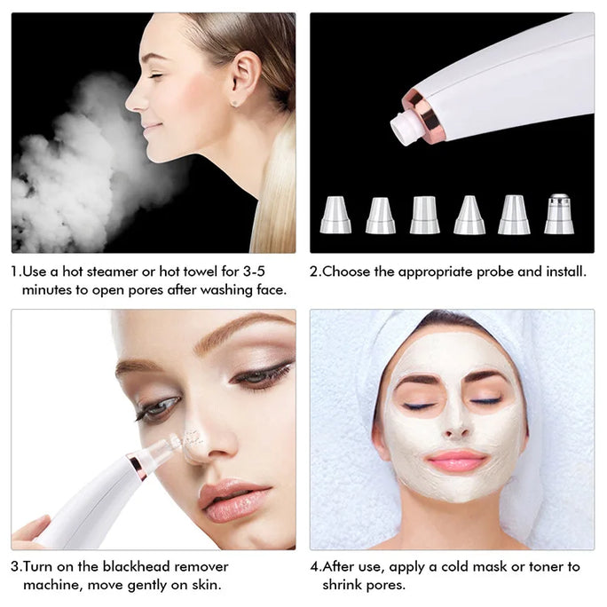 Electric Blackhead Remover -  Acne & Pore Cleaner Machine