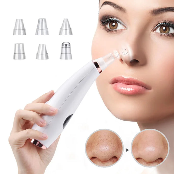 Electric Blackhead Remover -  Acne & Pore Cleaner Machine